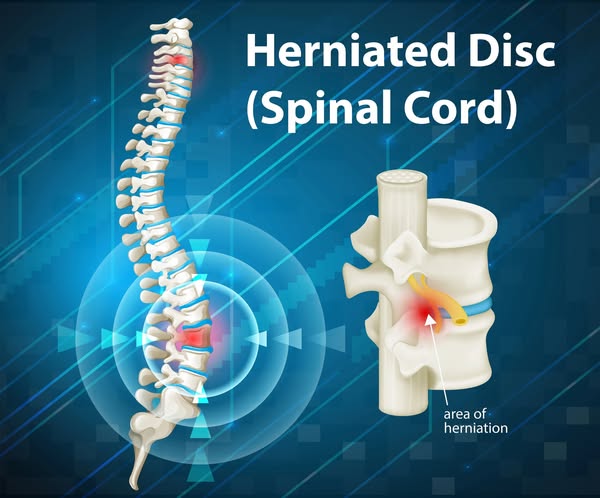 Adjusted Chiropractic Studios Facebook ad