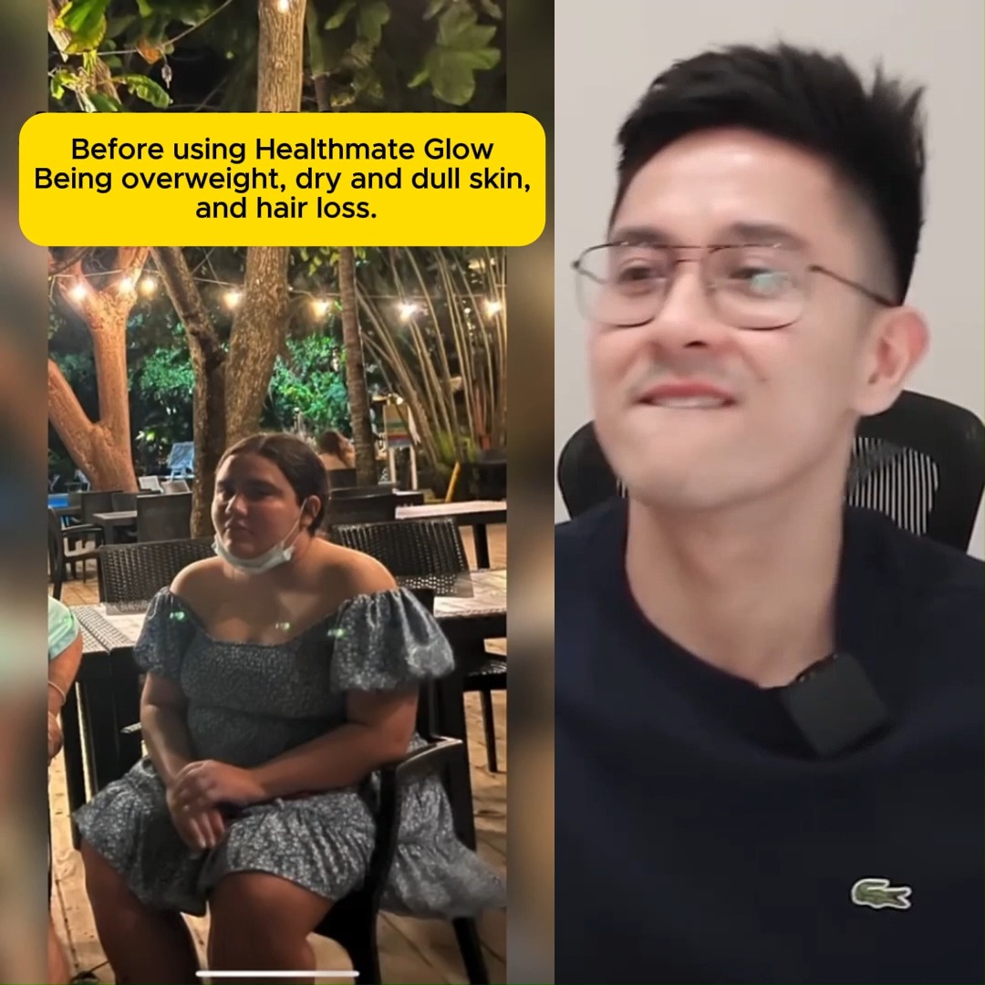 Healthmate Supplements Facebook ad: GUSTO MO BA NG MAS MAKINAG NA BALATโฆ