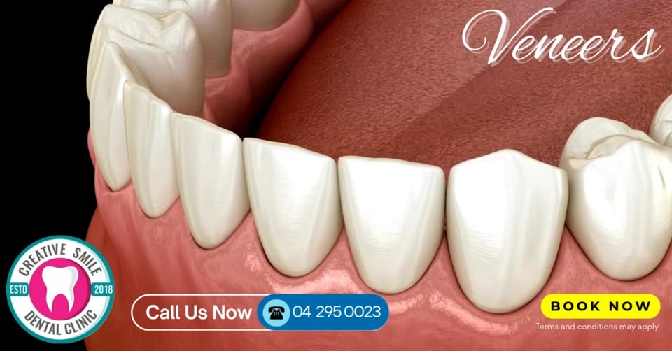 Creative Smile Dental Clinic Al Rigga Facebook ad: Your Smile, Perfected by Experts!