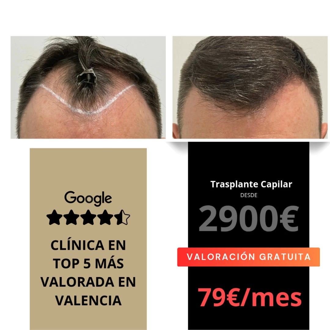 Clínica salud capilar  Facebook ad