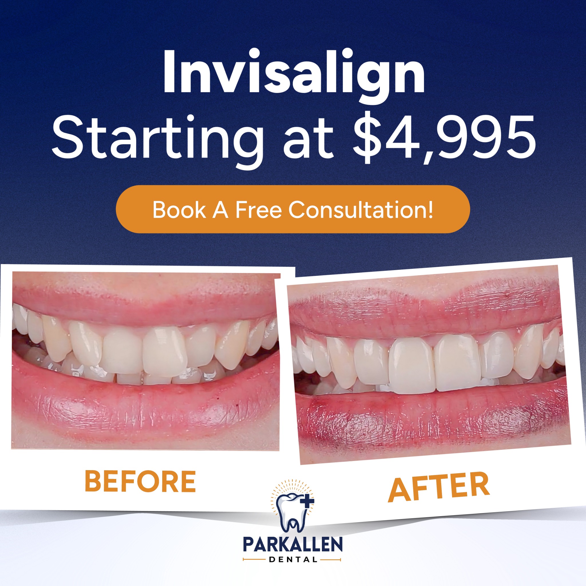 Park Allen Dental Facebook ad