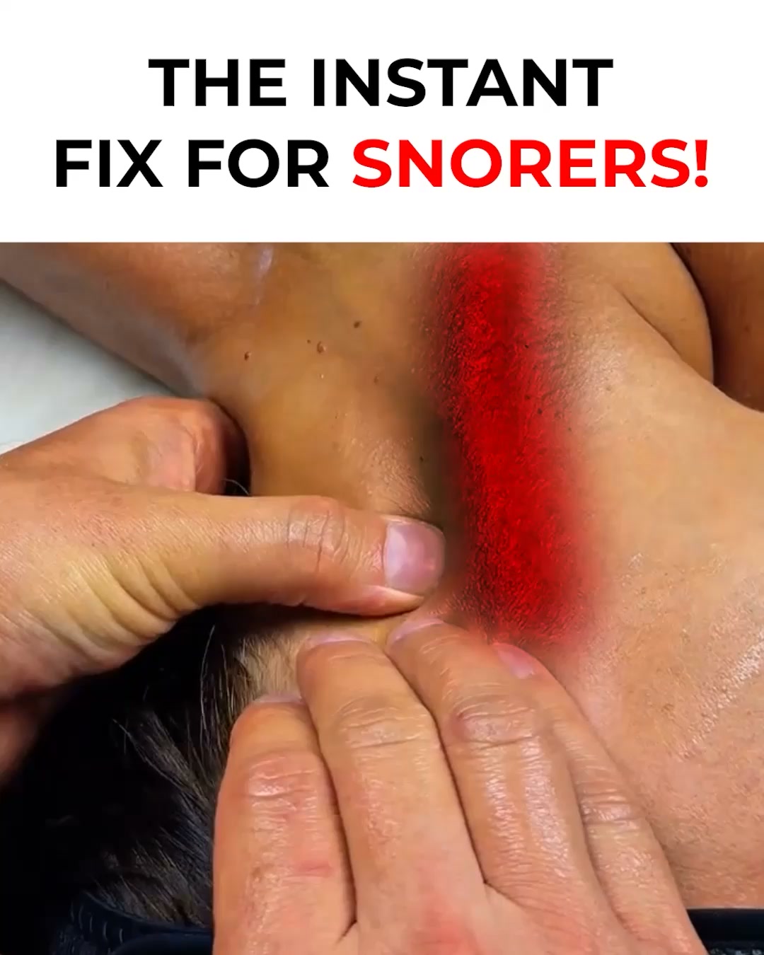 Honex Facebook ad: Fix Snoring & Sleepless Nights