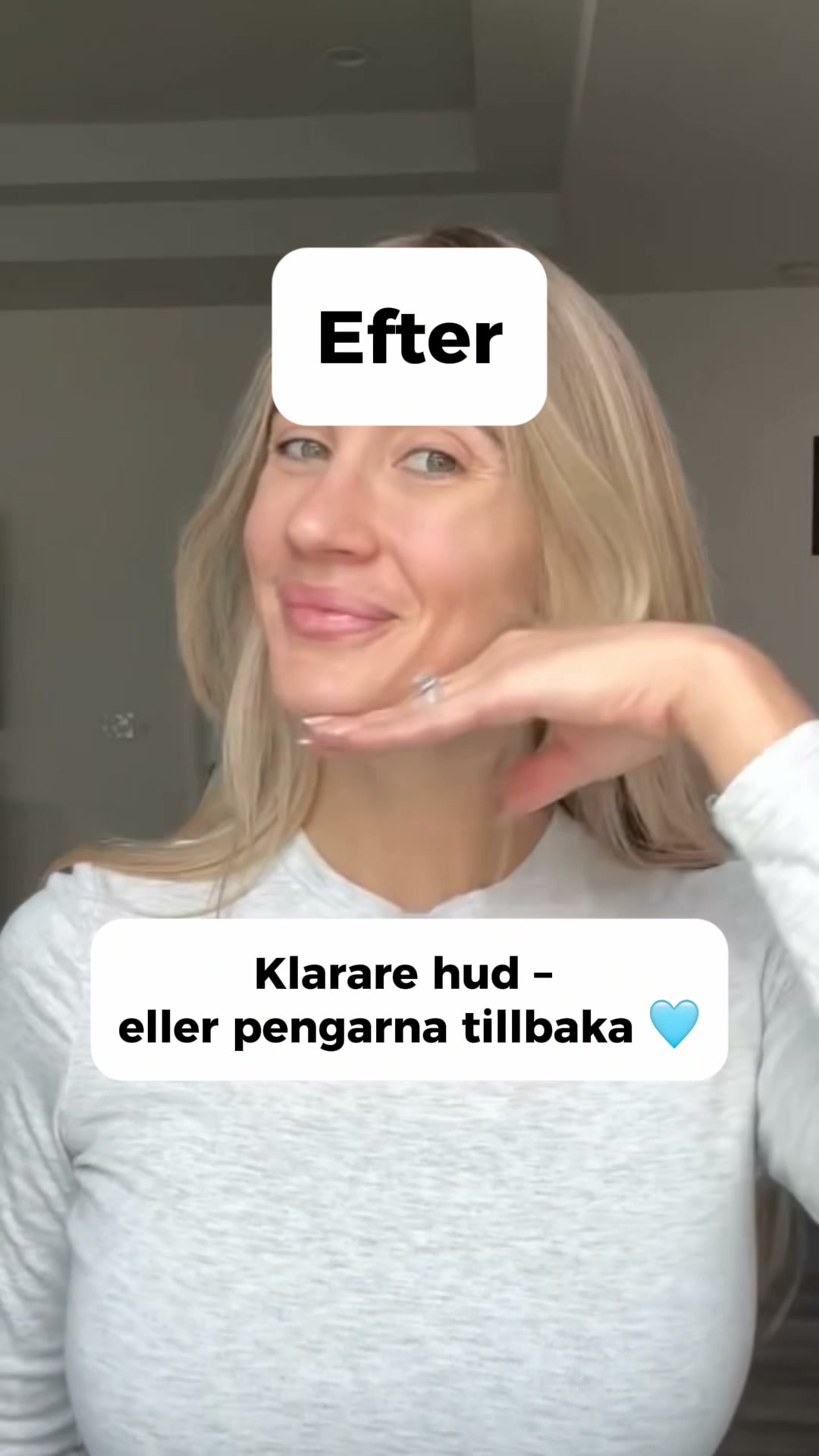 LovieBaby Facebook ad: Naturlig hudvård för akne