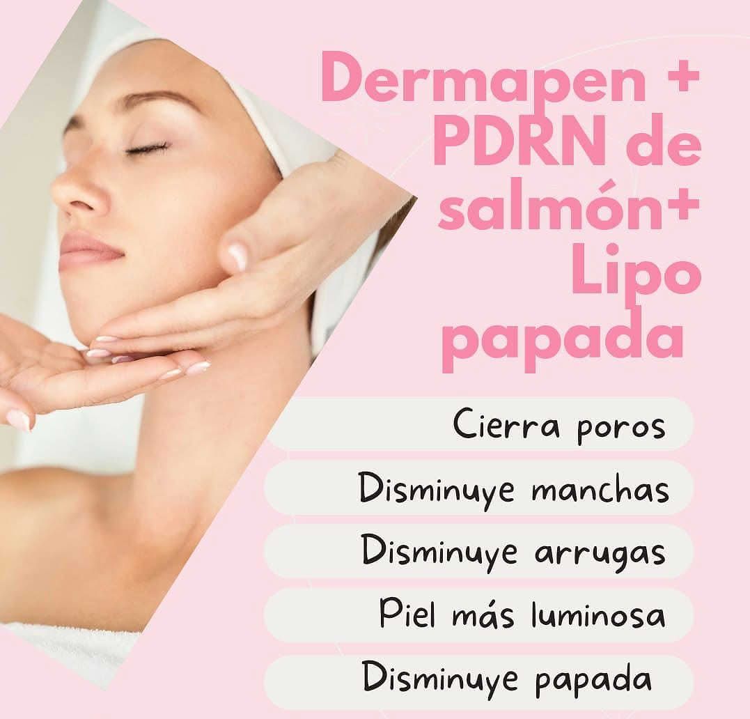 spacio bienestar cosmetología Facebook ad: dermapen en rostro, cuello y escote + lipo…