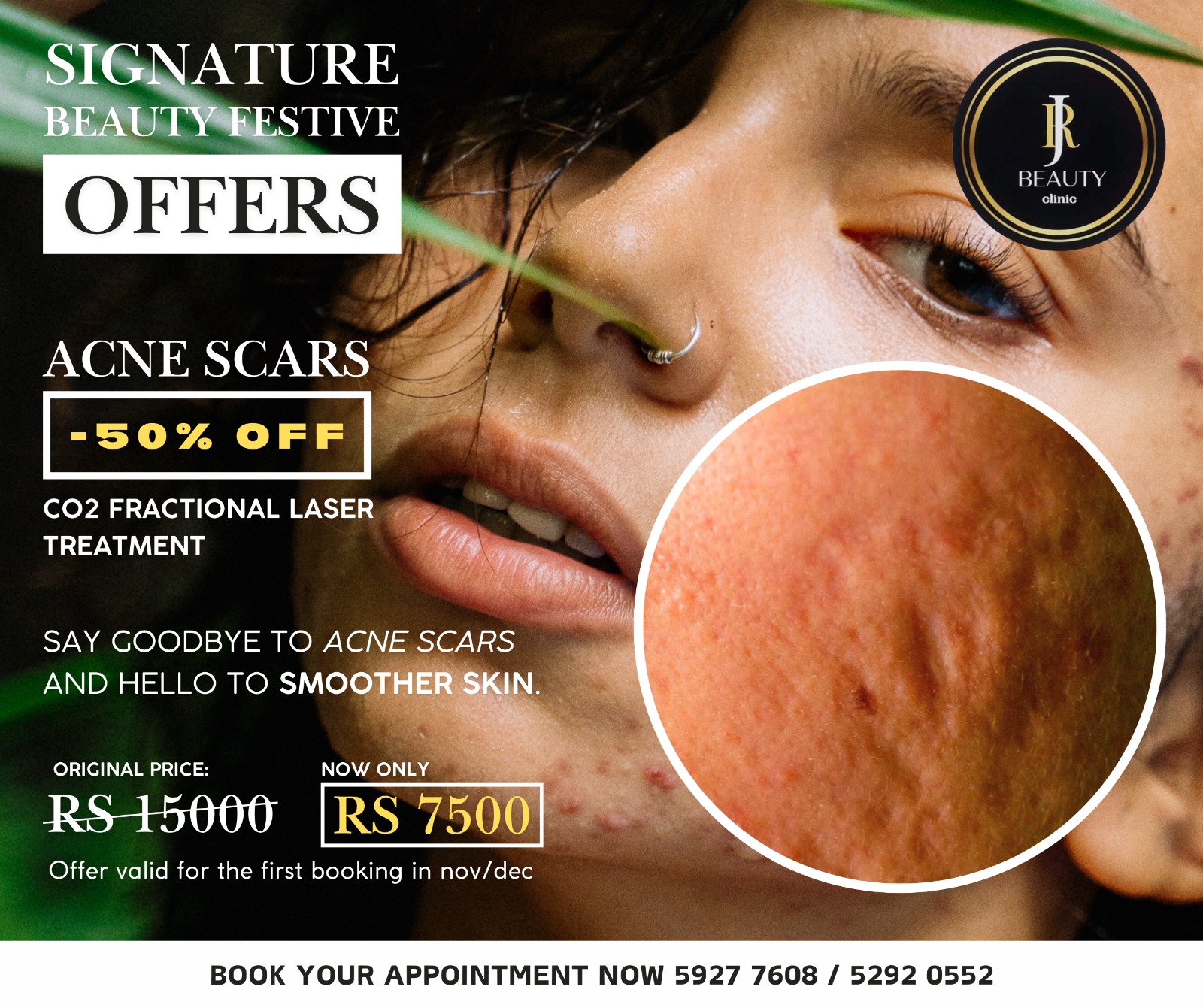 JR Beauty Clinic Facebook ad