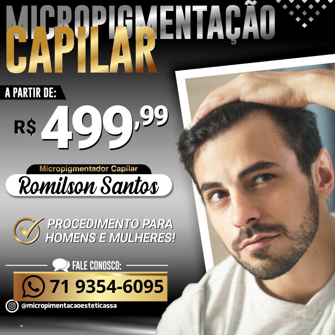 Micropigmentação Capilar RS Facebook ad: Micropigmentação Capilar 3D Realista
