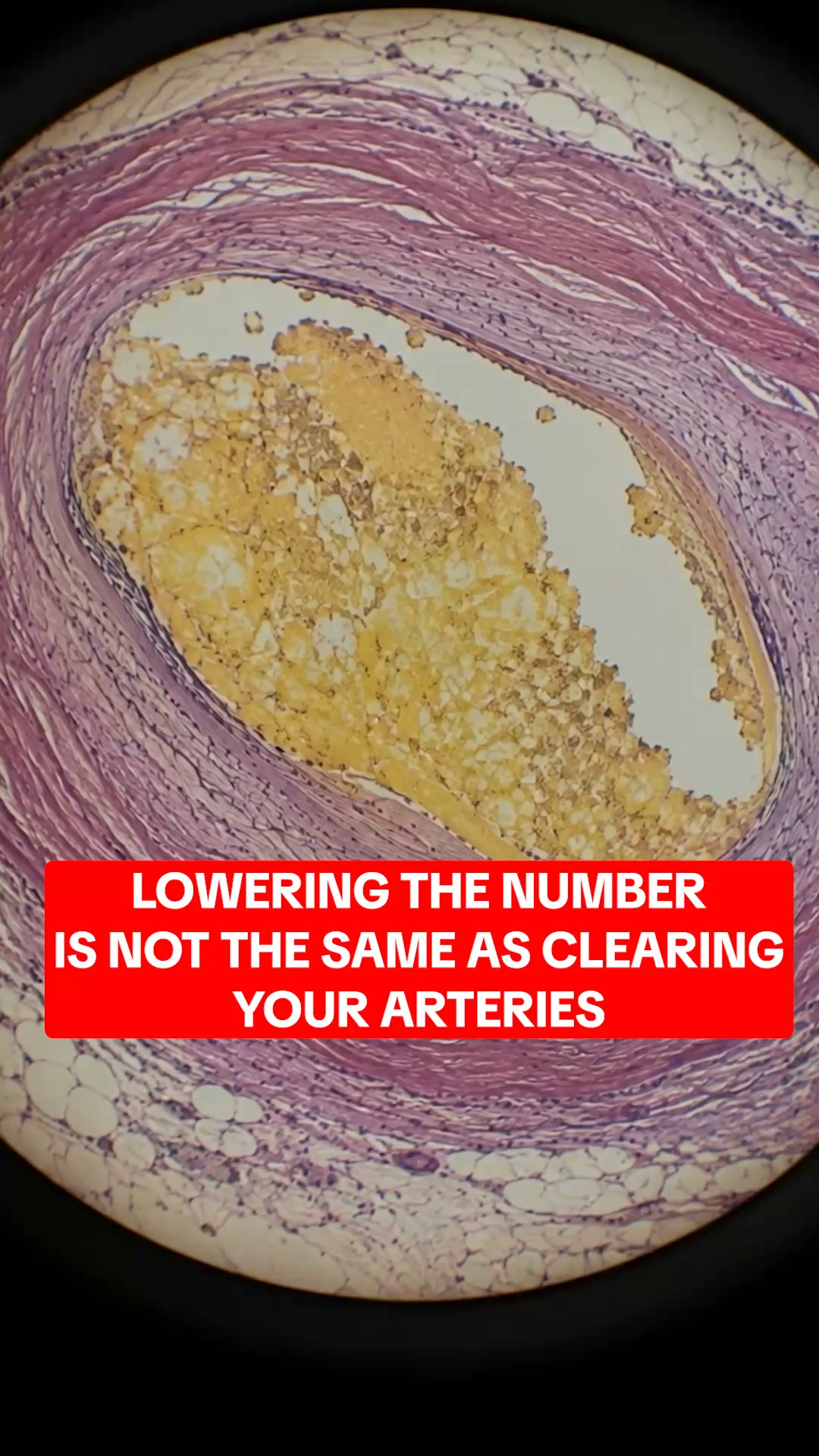Cholesterol Support Group Facebook ad: Support yourself today
