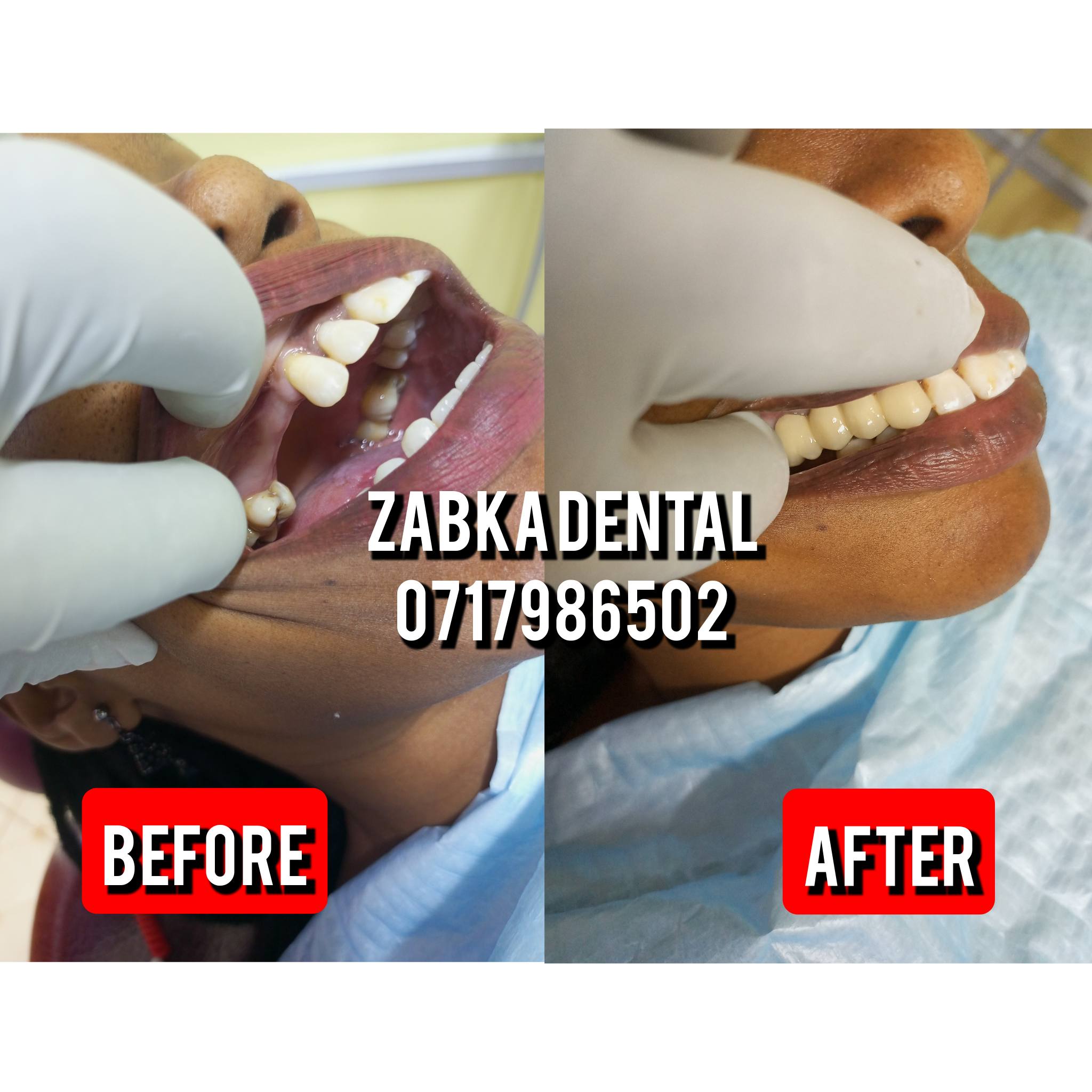 Zabka Dental Services Facebook ad