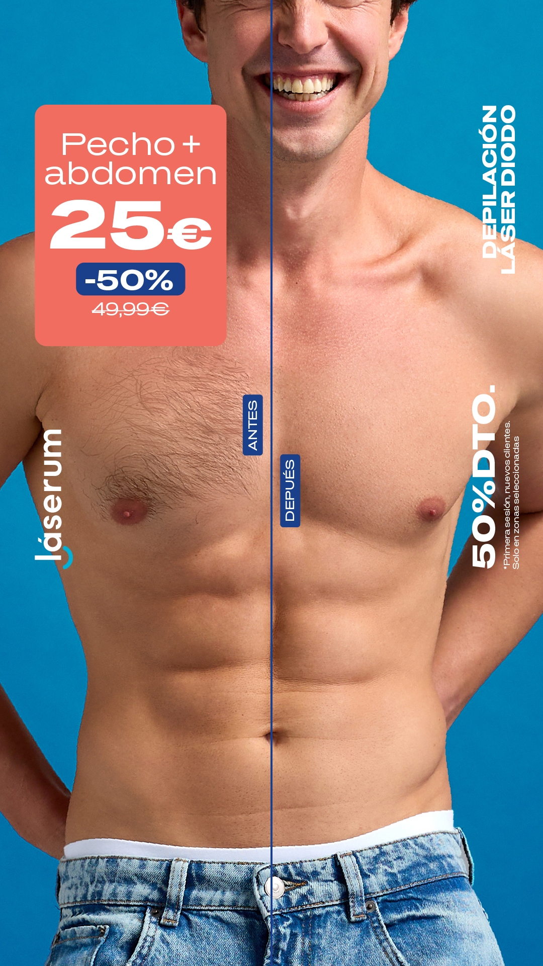 Láserum Facebook ad