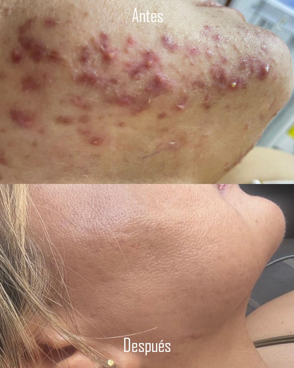 Dermatóloga Yolima Mercado Facebook ad: Si tu piel tiene alguna patología o simplemente…