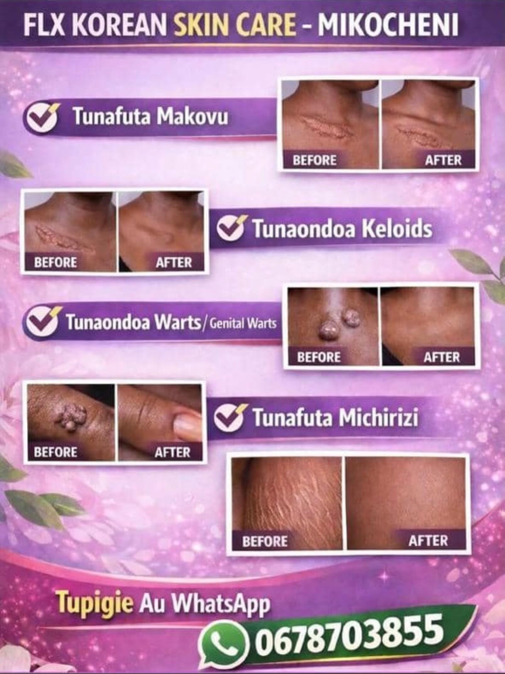 FLX Aesthetic Clinic Facebook ad: HUDUMA ZETU, FLX Aesthetic Clinic
