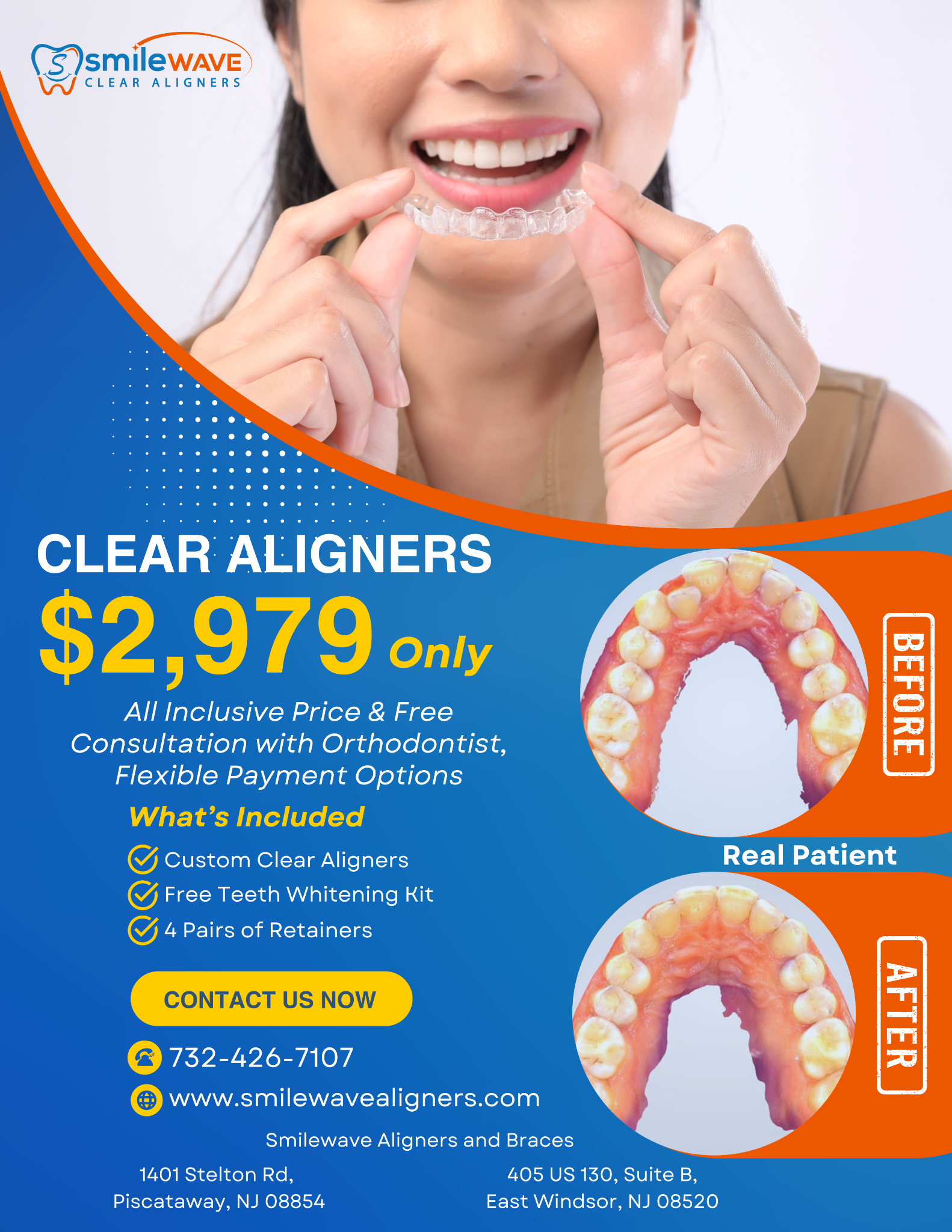Smilewave Aligners & Braces Facebook ad
