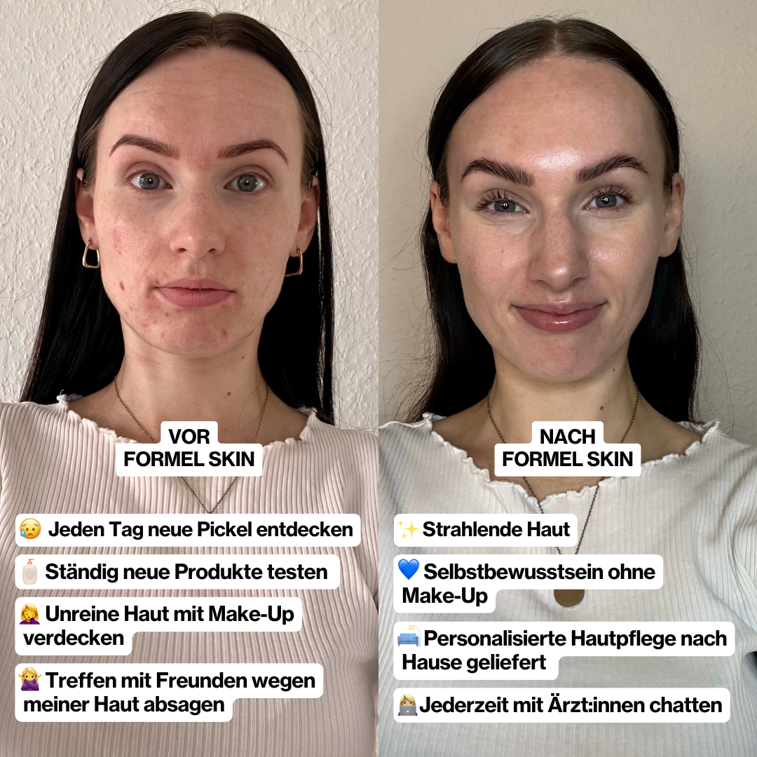 FORMEL SKIN Facebook ad from Dec 1, 2025