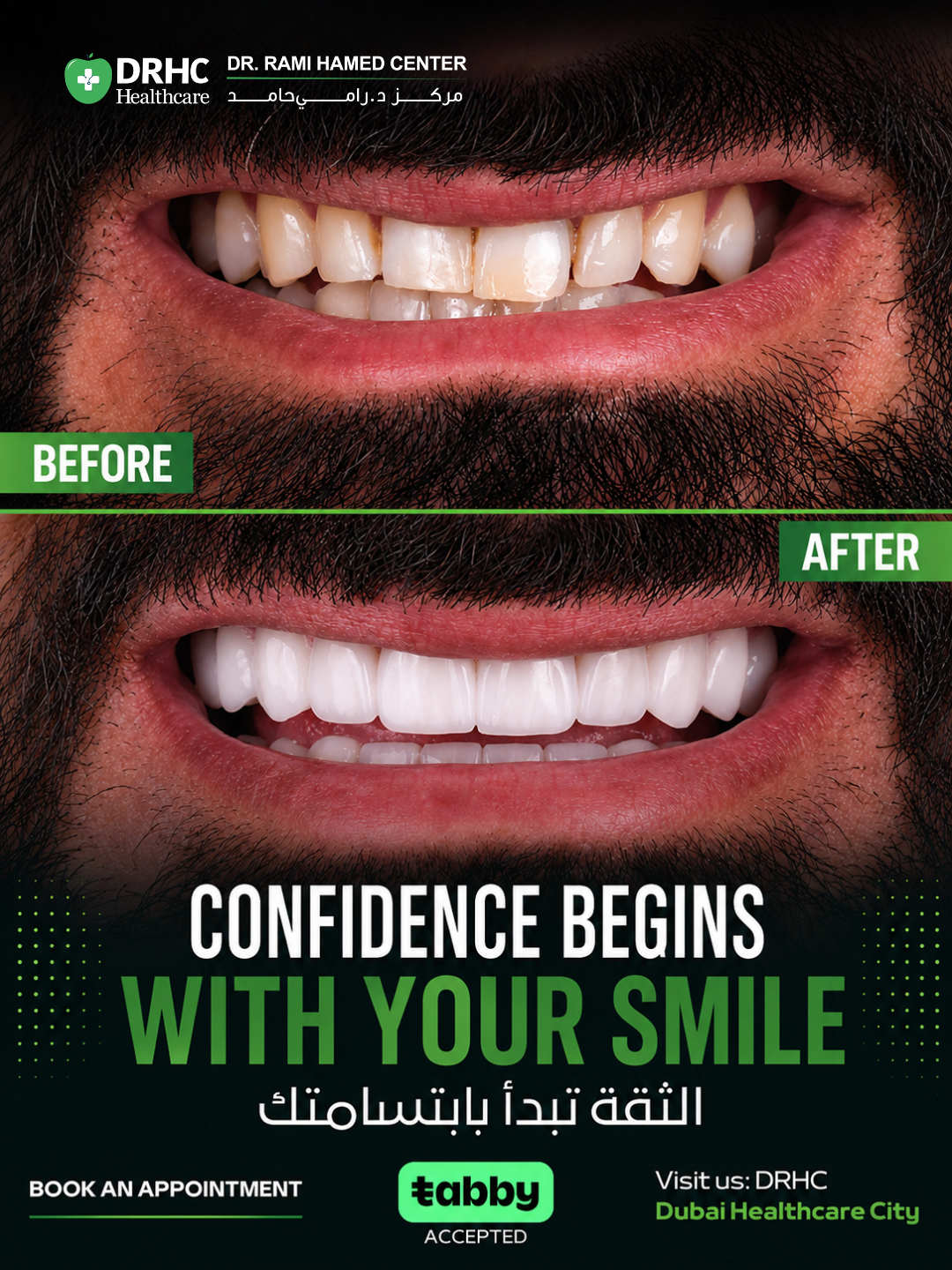 Dr Rami Hamed Center Facebook ad: Considering Dental Veneers?