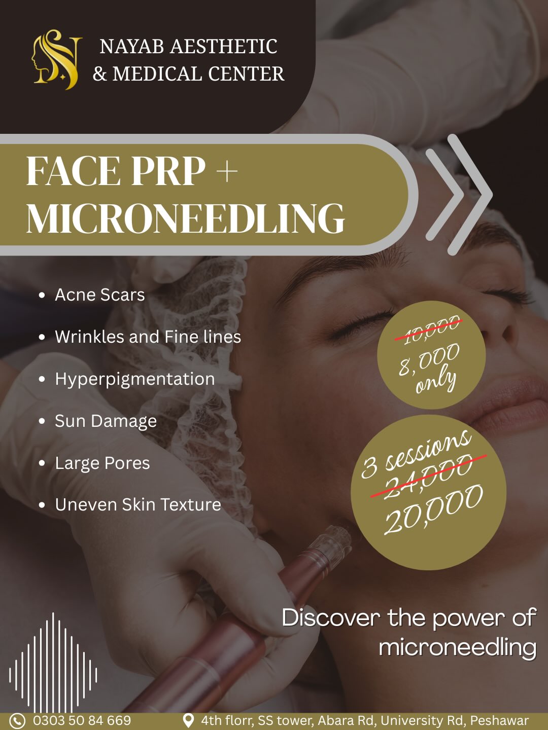 Nayab Aesthetic Facebook ad: PRP with Microneedling