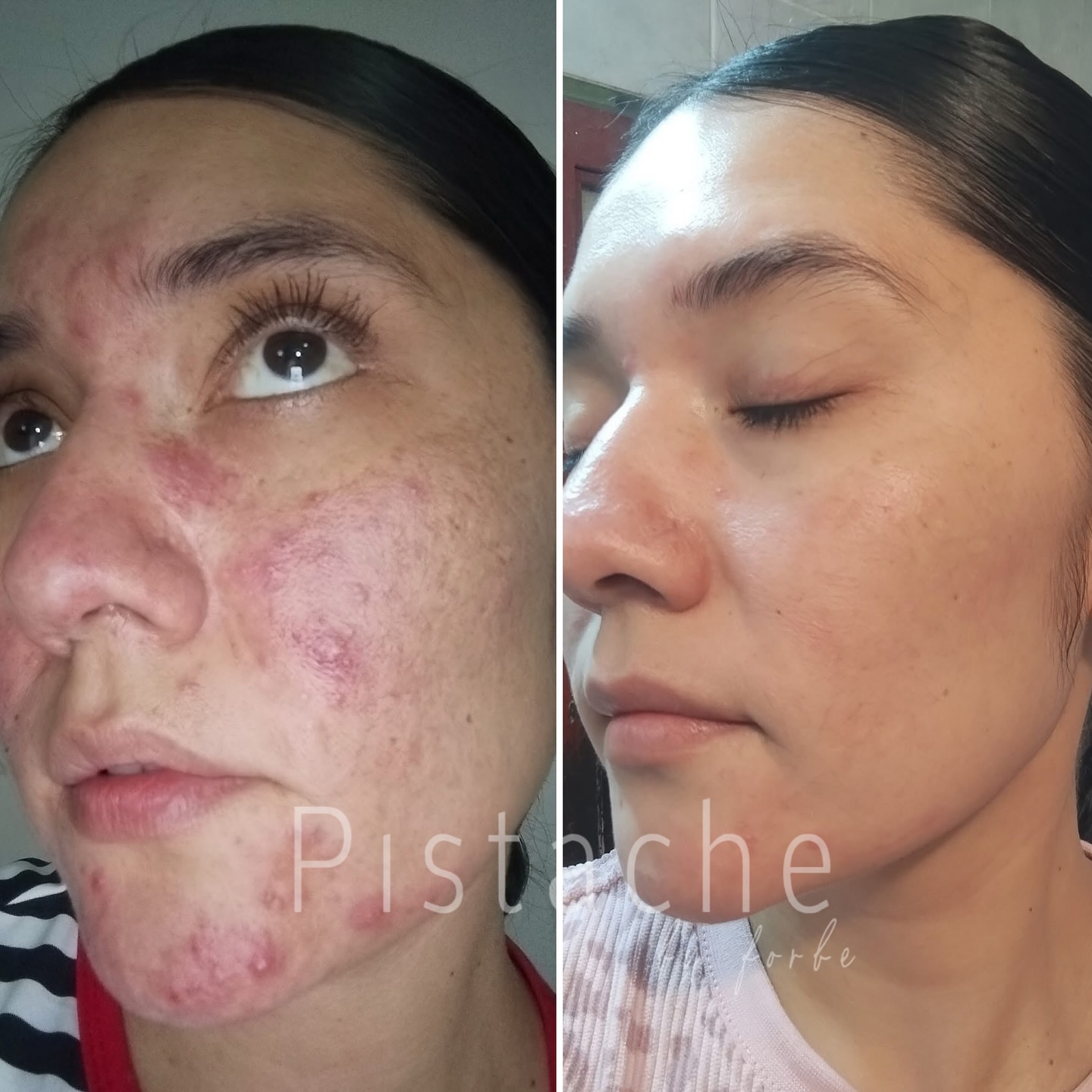 Pistache Facebook ad