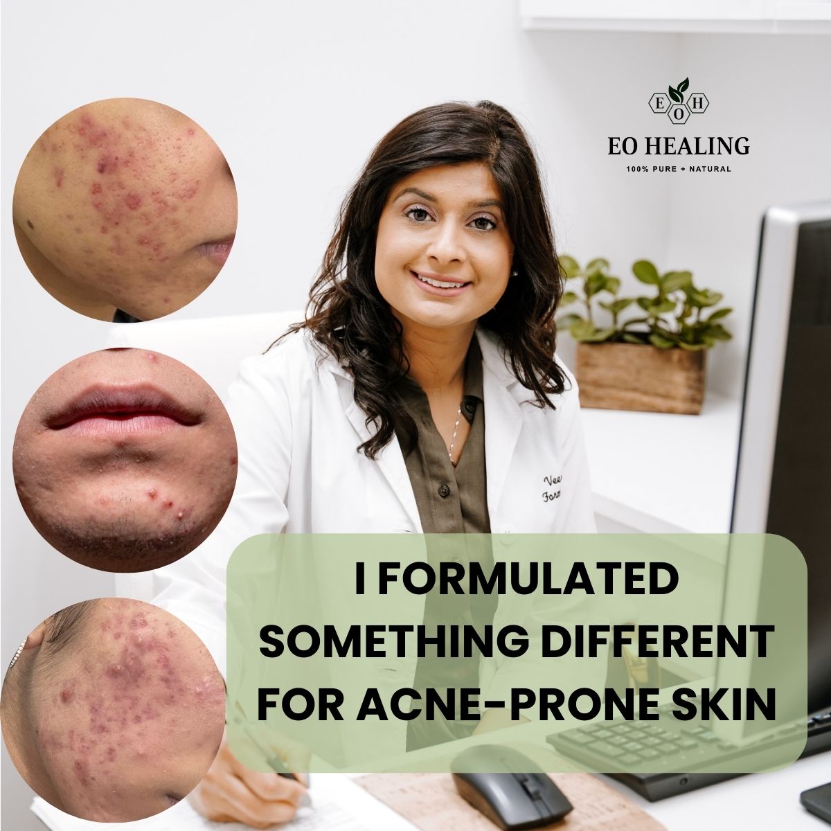EO Healing LTD. Facebook ad: As a cosmetic chemist, I formulated something different…