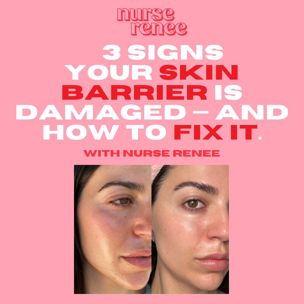 Nurse Renee Facebook ad