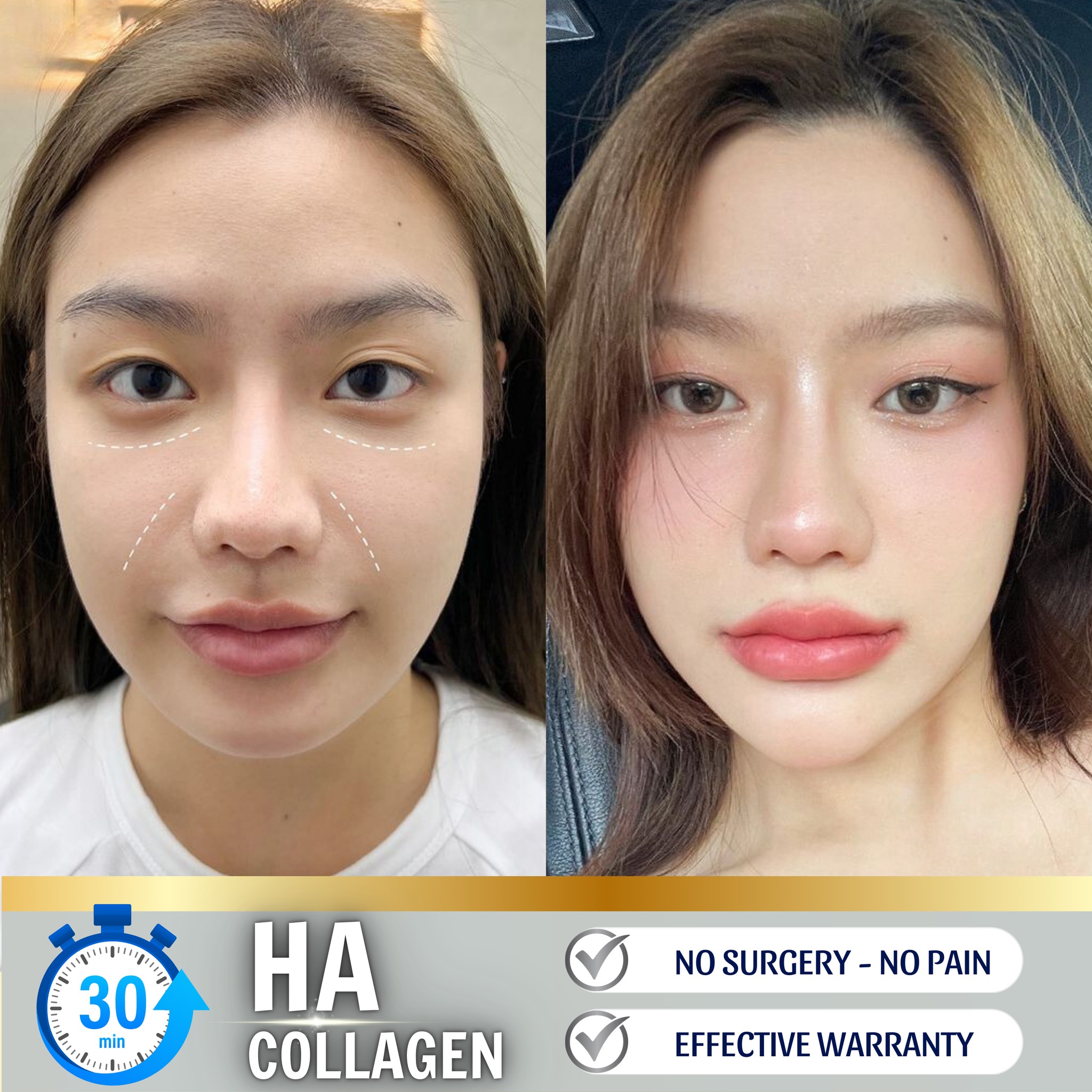 Nado Aesthetic Clinic Facebook ad