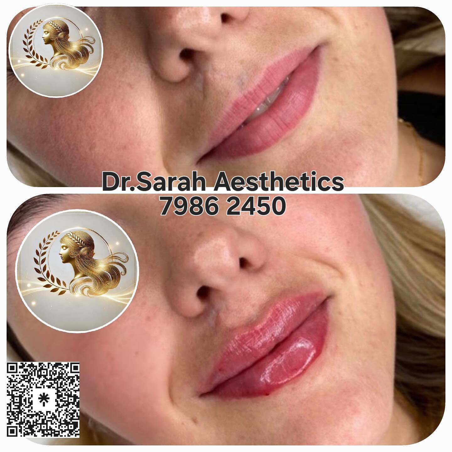 Dr.Sarah Aesthetics Facebook ad: Plump, Hydrate & Define with Lip Fillers!