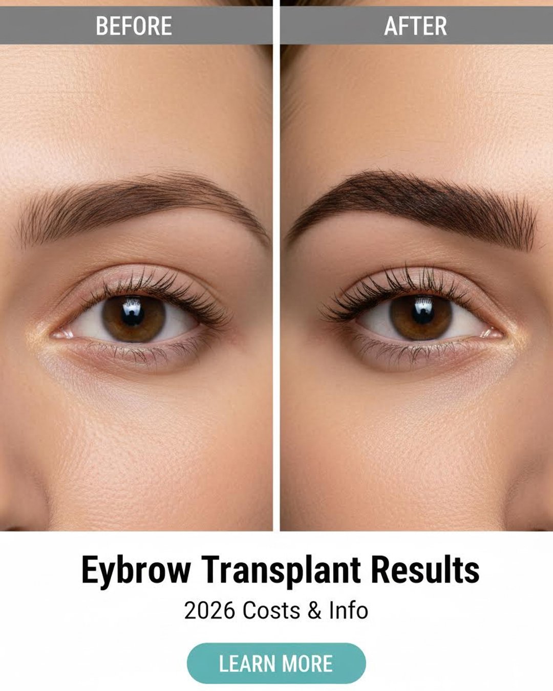 Weekly 1st Facebook ad: Eyebrow Transplant Cost 2026