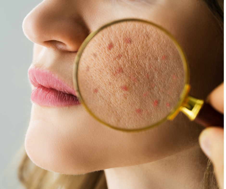 Blush Problematic Skincare Solutions Facebook ad