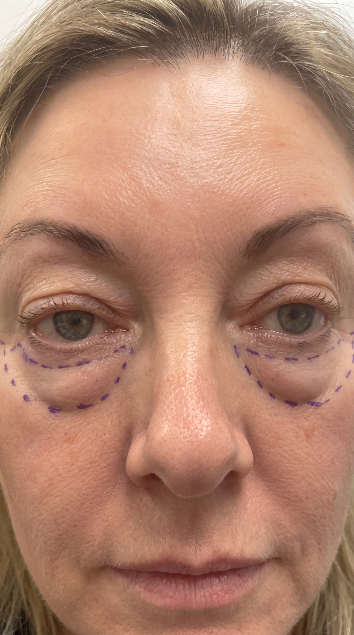 Dr. Amelia Whitmore Facebook ad: A Retired Eye Surgeon Finally Speaks Up