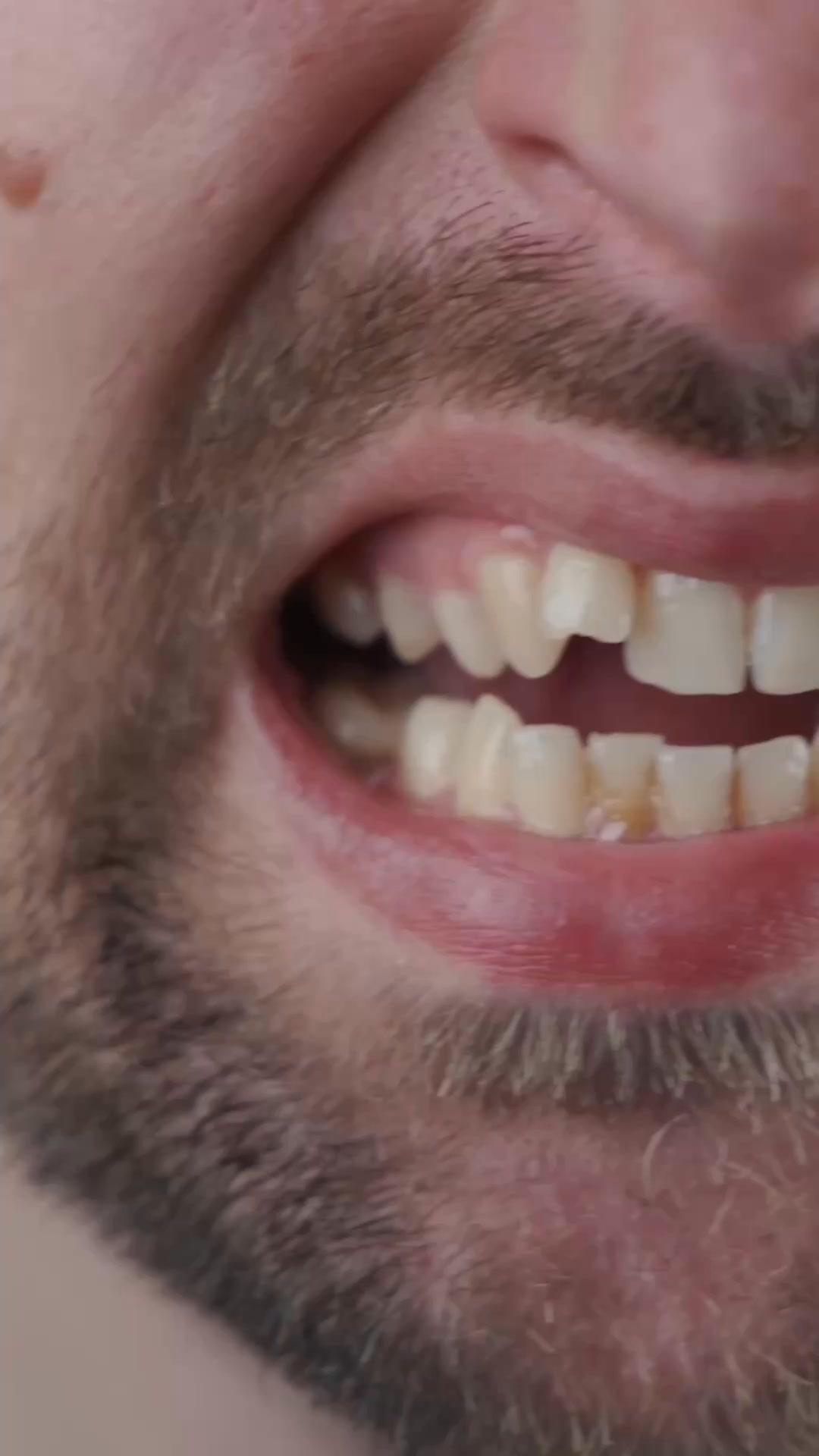Ortodoncia Lozano Facebook ad: No va de dientes rectos. Va de cómo te sientes