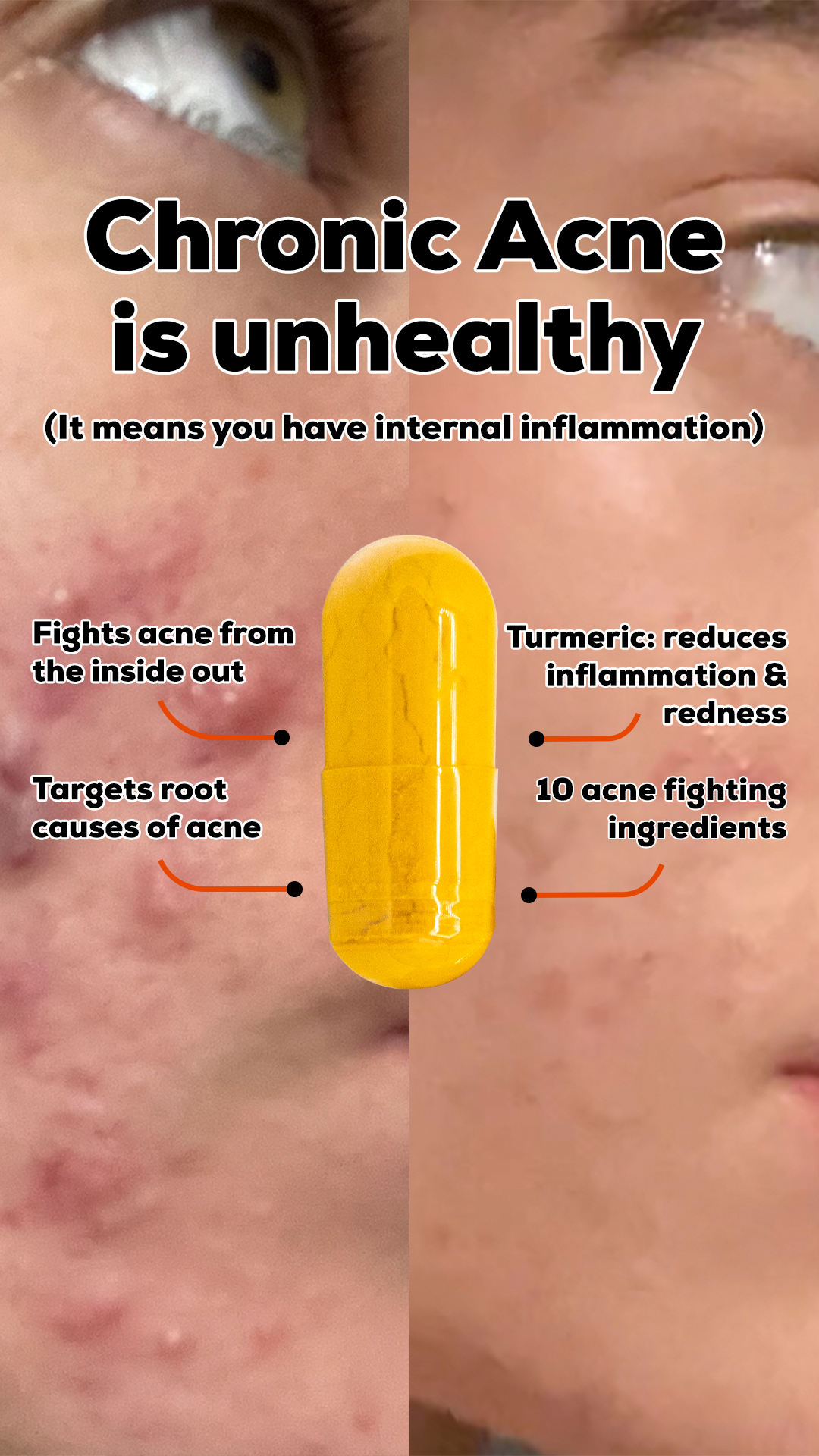 Within Skin Facebook ad