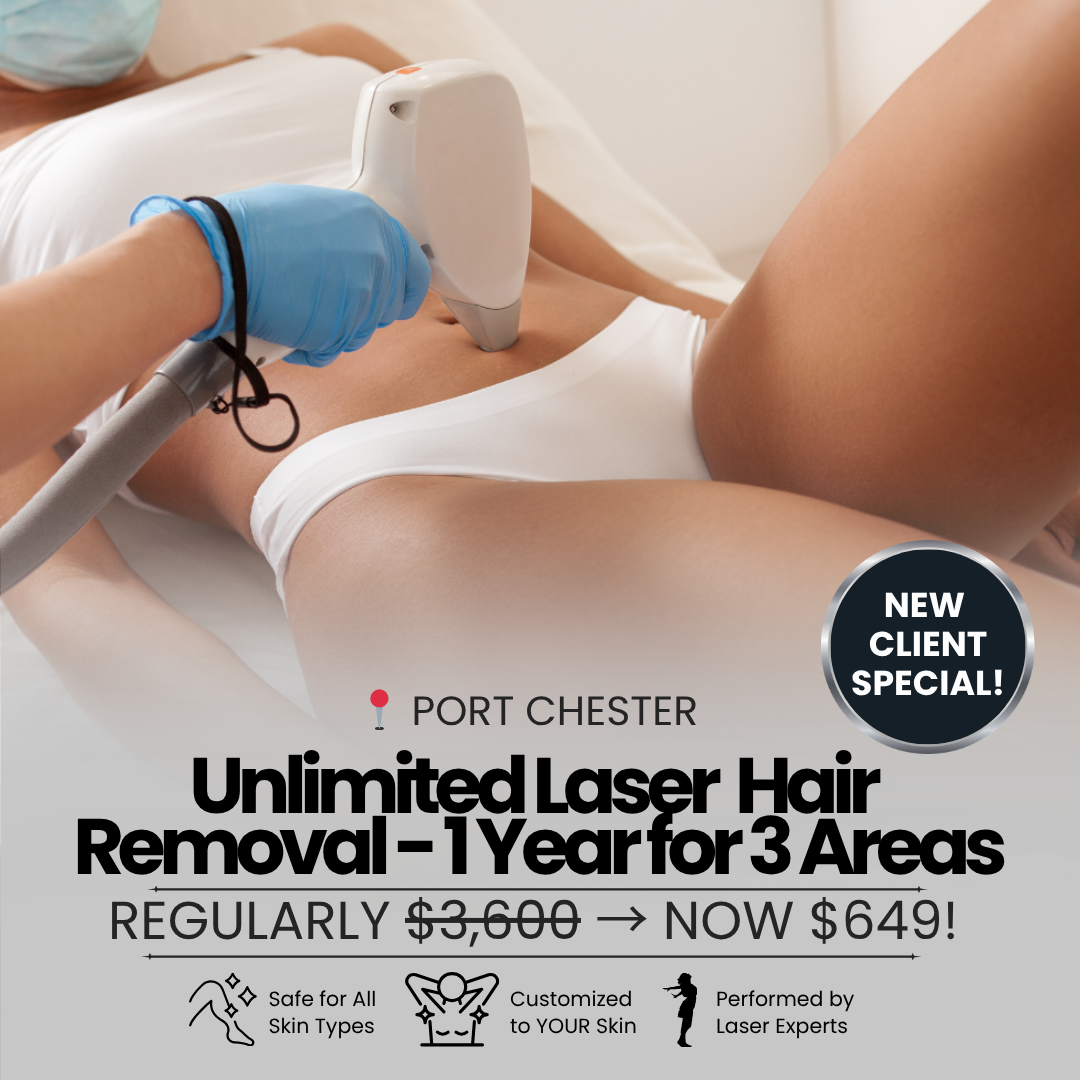 Sense Medical Spa Facebook ad: Unlimited Laser Hair Removal for 1 Year NOW $649