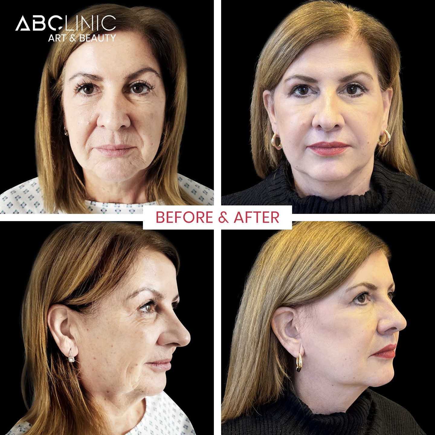 ABClinic Art & Beauty Facebook ad: Mladší, ale stále já!