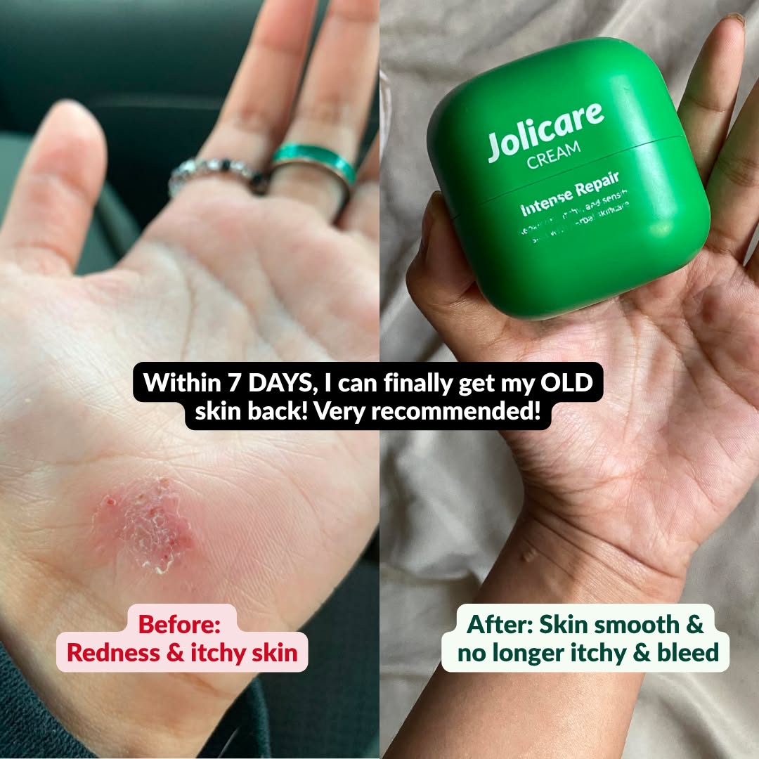 Jolicare Facebook ad