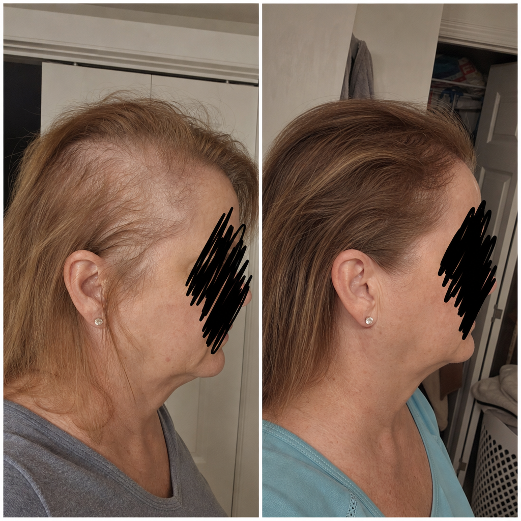 Susan Miller Facebook ad