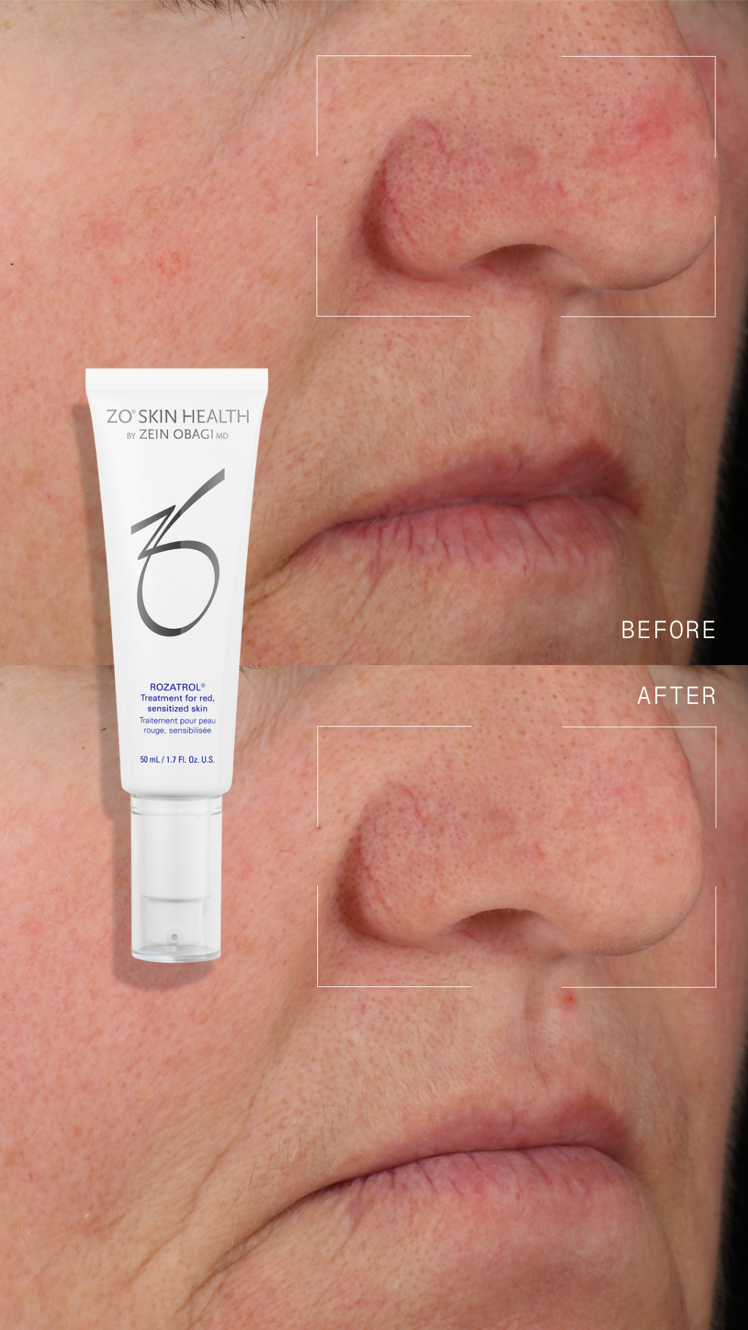 ZO Skin Health Facebook ad