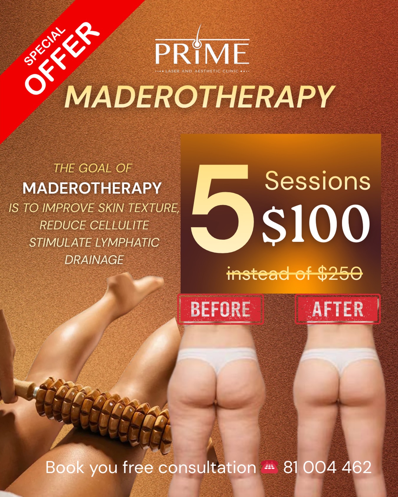 Prime Laser Clinic Facebook ad
