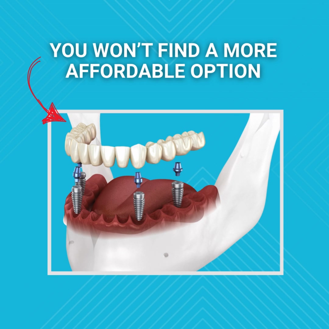 NuSet Dental Implants & Oral Surgery St. Louis Facebook ad: Get Pricing & Options!