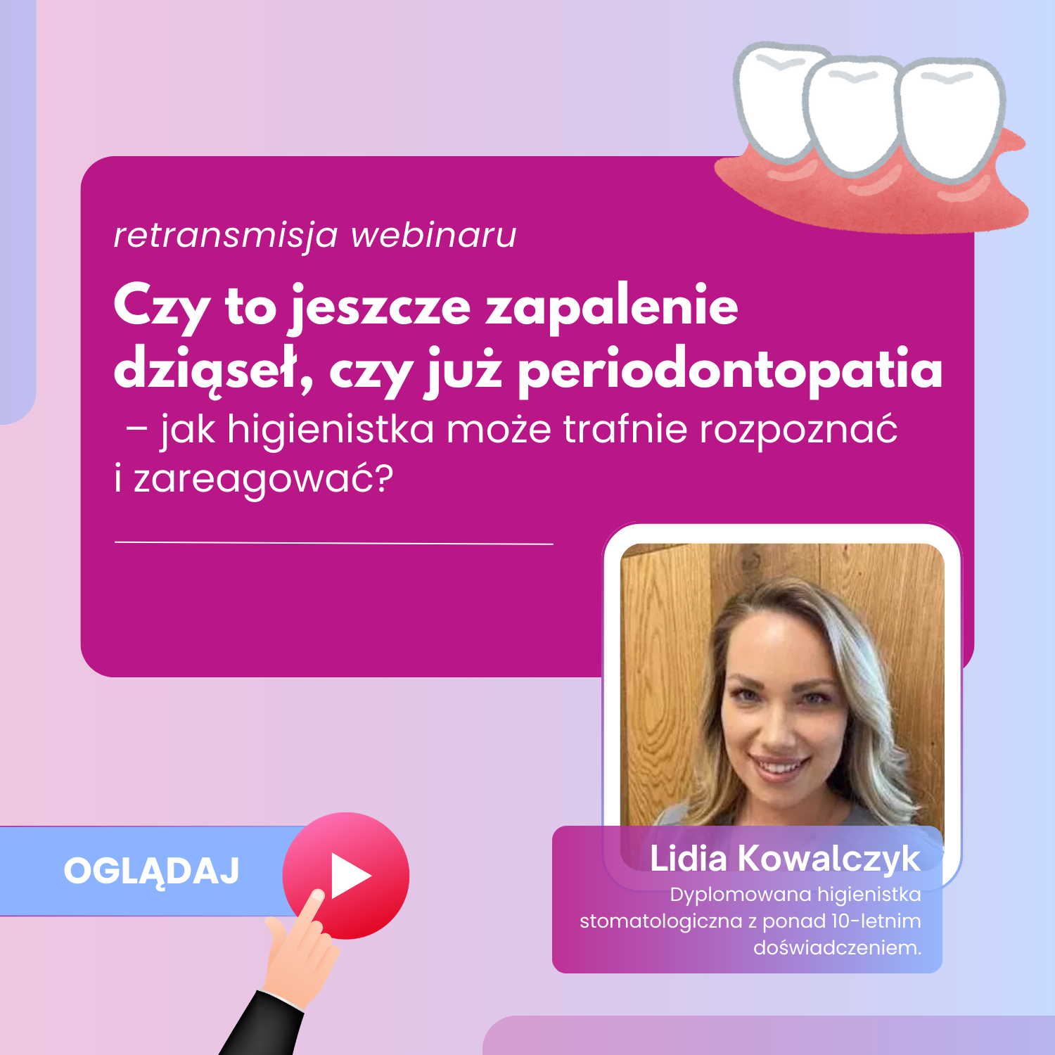 Edu ZOZ Facebook ad: Darmowy webinar dla Higienistek