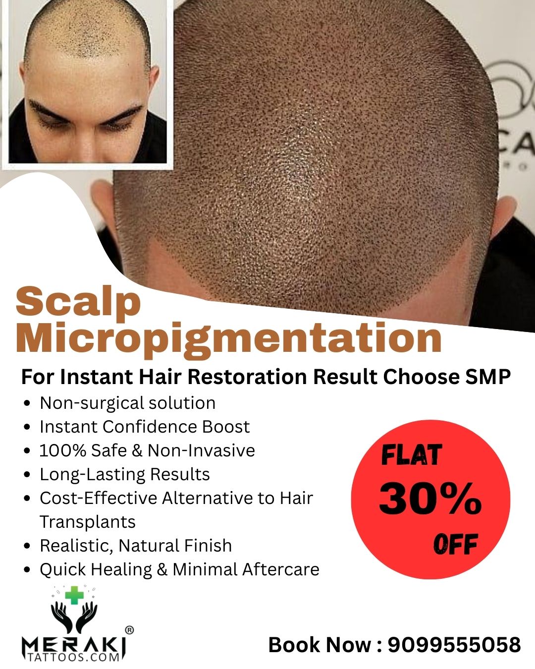 Meraki Tattoos & Body Piercing Facebook ad: Hair loss or baldness bothering you?