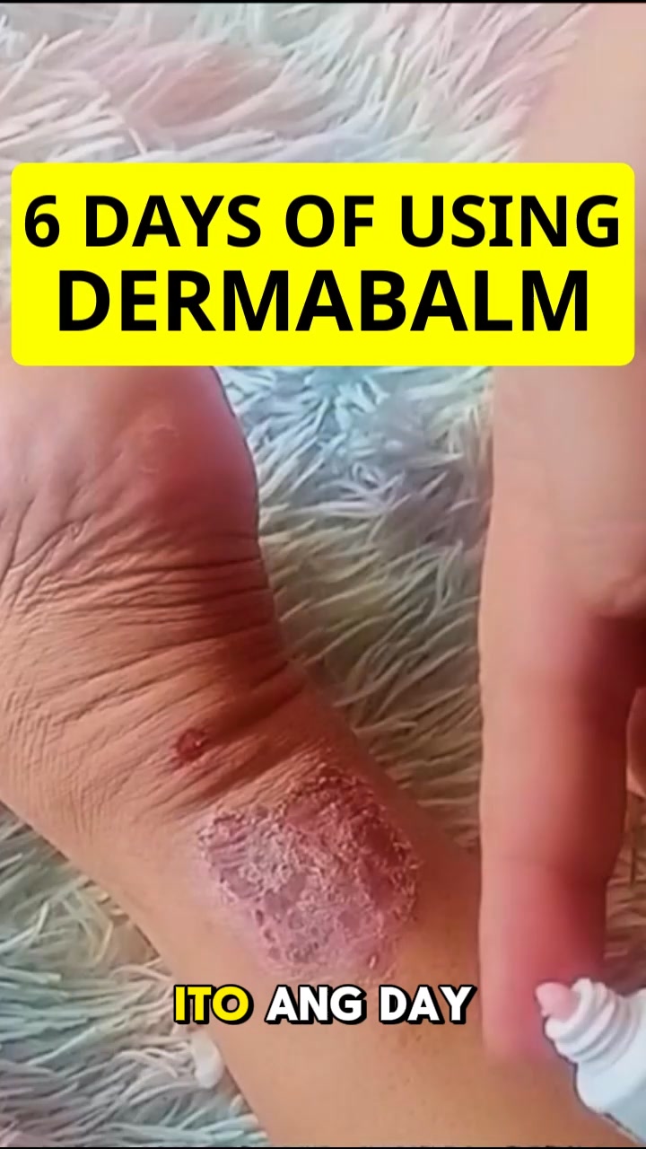 DermaBalm Philippines Facebook ad: Promo Alert