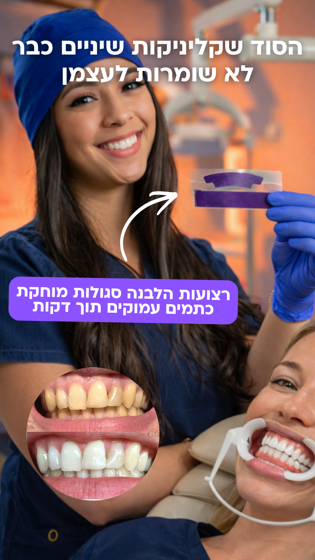 רופאי שיניים בישראל מדברים Facebook ad: רצועות ההלבנה הסגולות הראשונות בישראל