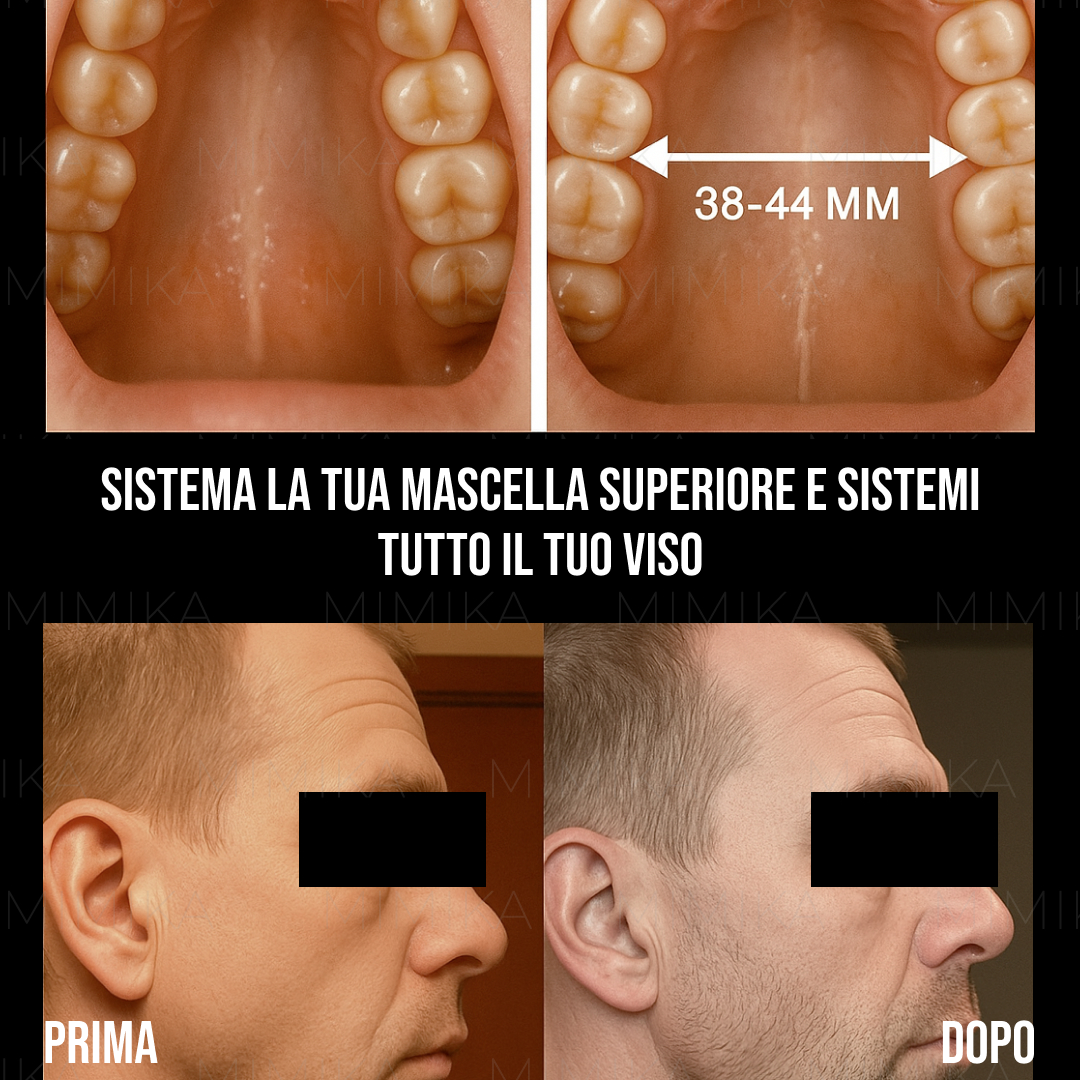 Mark Mewing Facebook ad