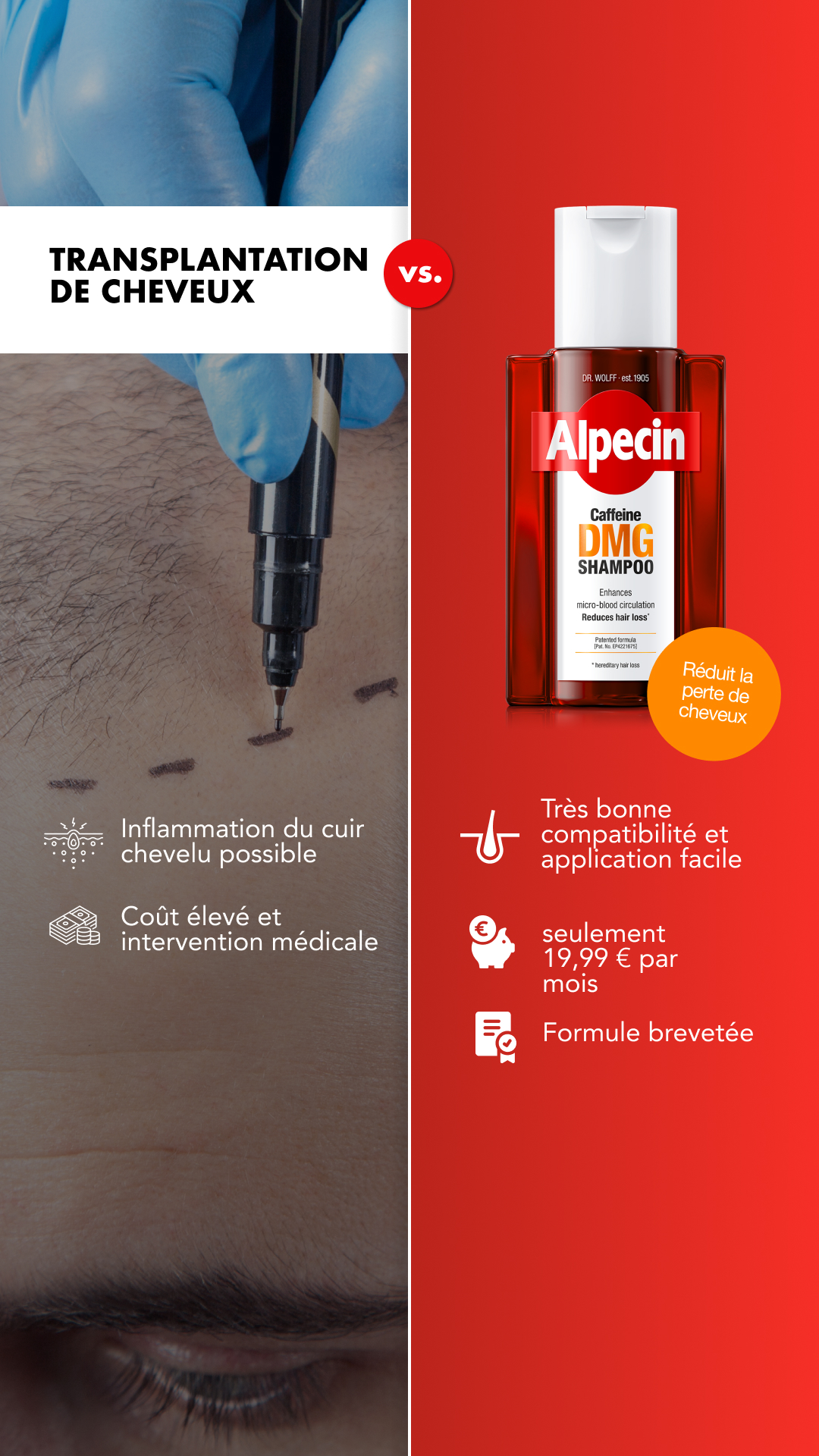 Alpecin Facebook ad from Jul 2, 2026
