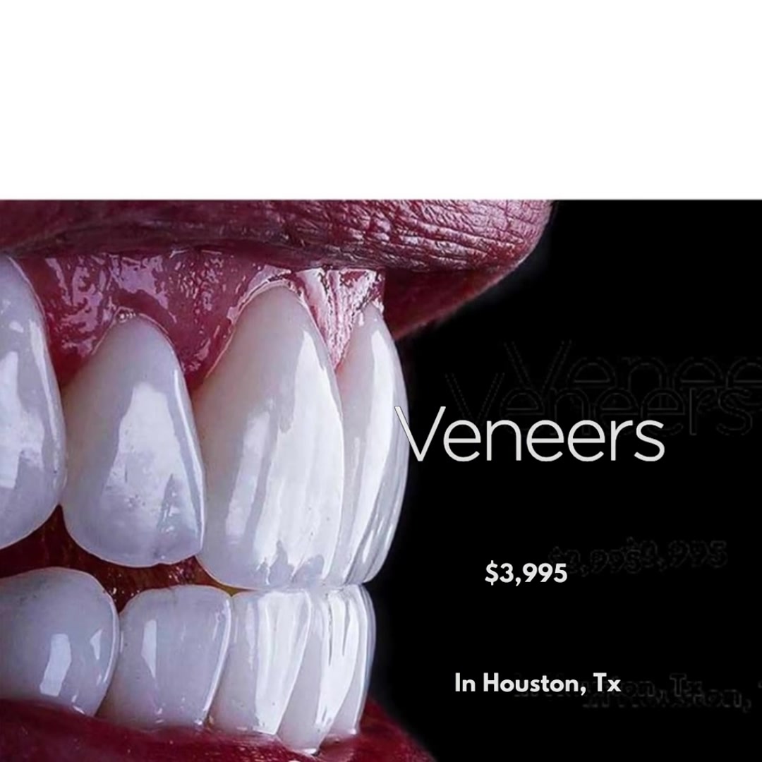 Nu Dentistry Facebook ad: Smile Makeover $3,995
