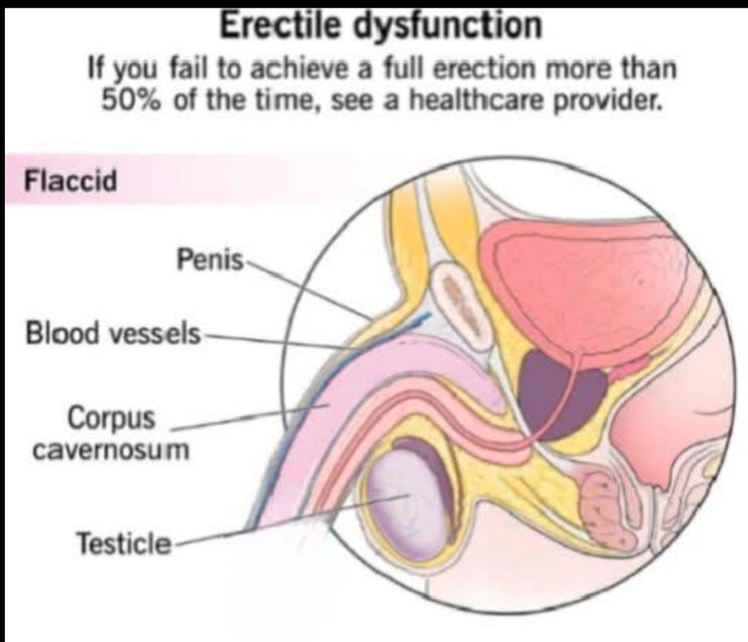 Medicare Health and wellness center Facebook ad: ERECTILE DYSFUNCTION