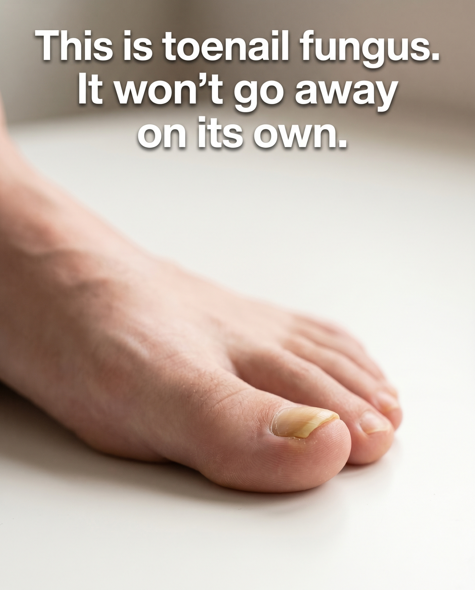 Dermachom Facebook ad: No Pills. No Prescription. No Liver Risk.