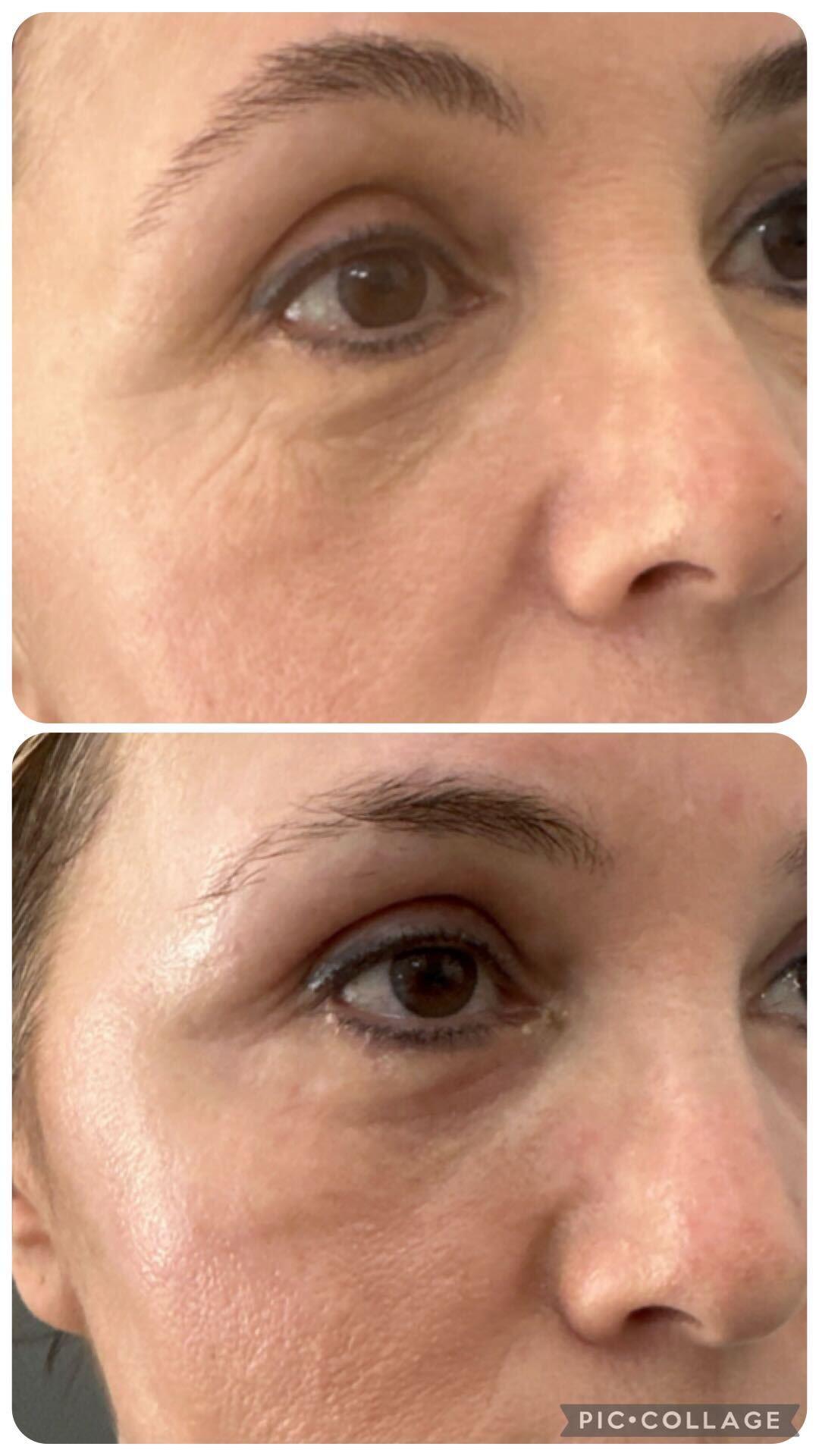 True You Skin Clinics Facebook ad