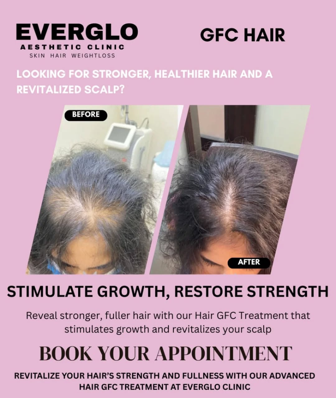 Everglo rs puram Facebook ad