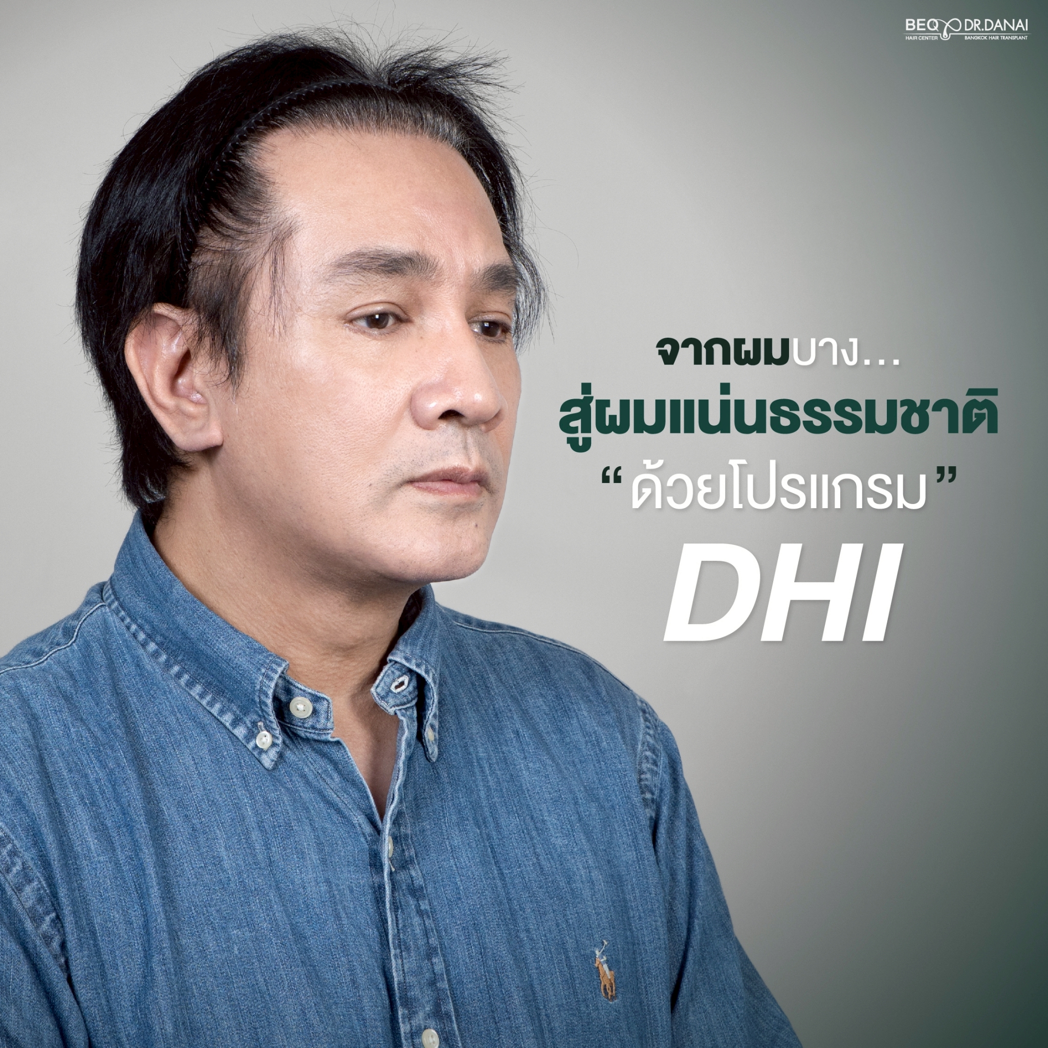 Dr. Danai Bangkok Hair Transplant ปลูกผมถาวร Facebook ad