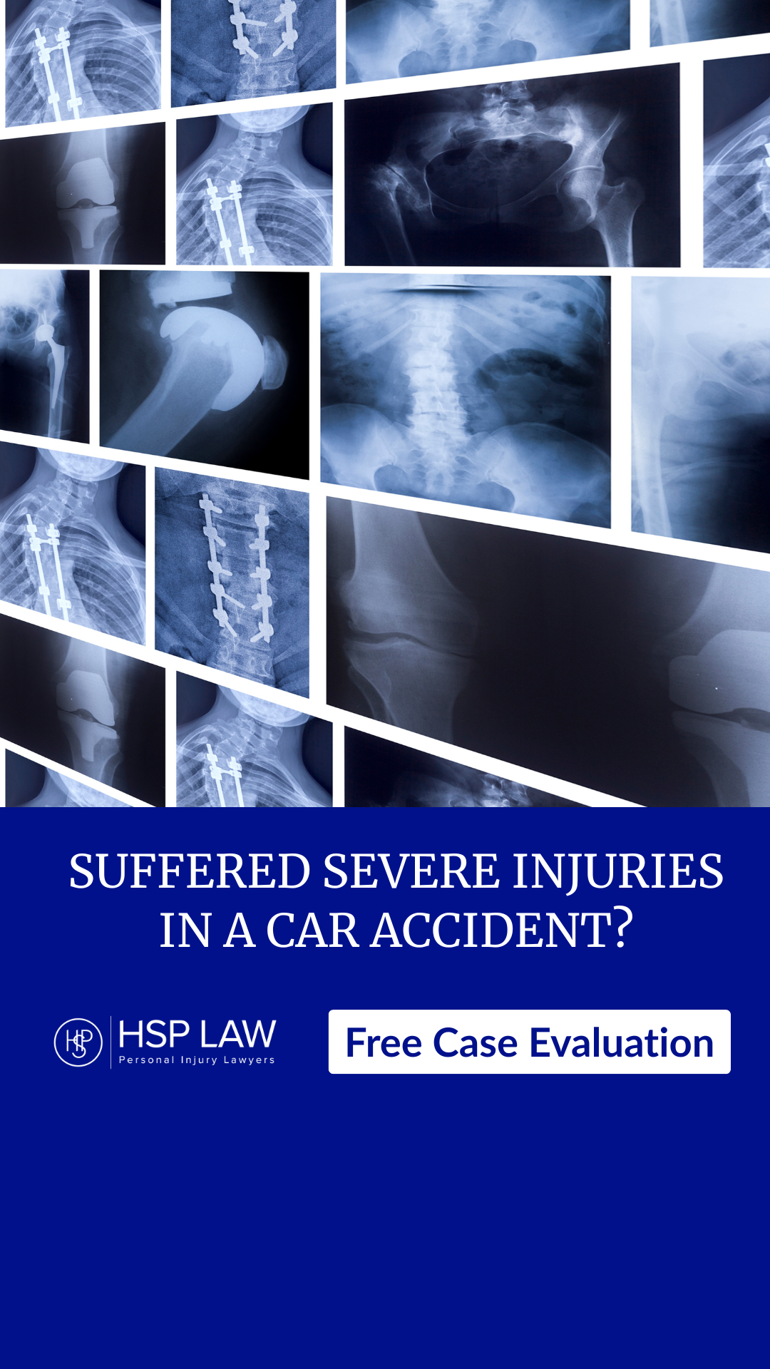 HSP LAW Facebook ad from Jul 9, 2026