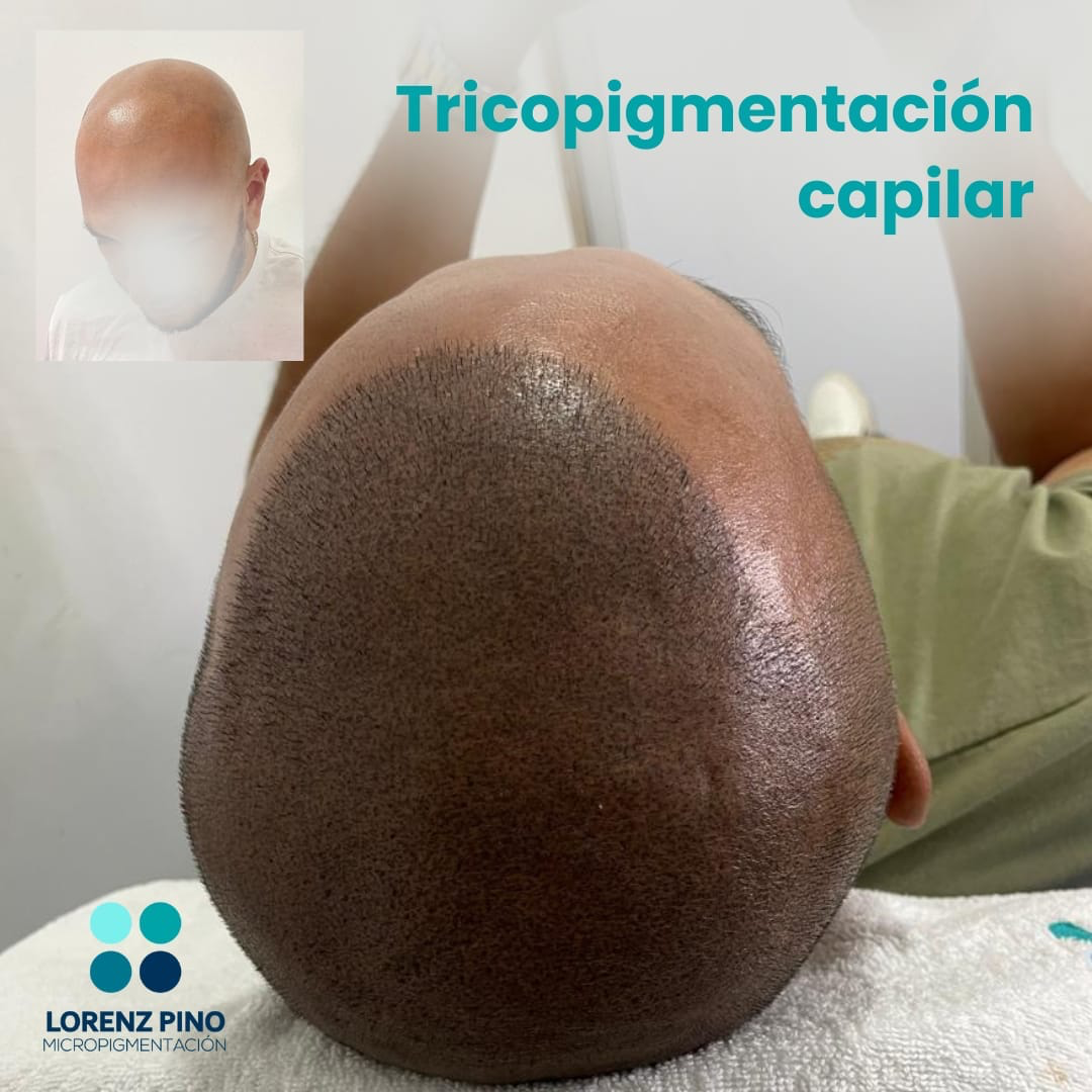 Lorenz Pino Facebook ad: ¡Trico!